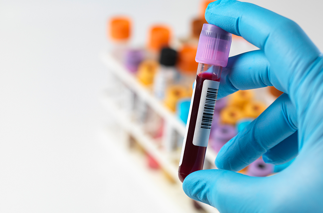 Vial of blood