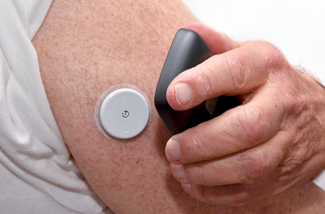 Glucose monitoring