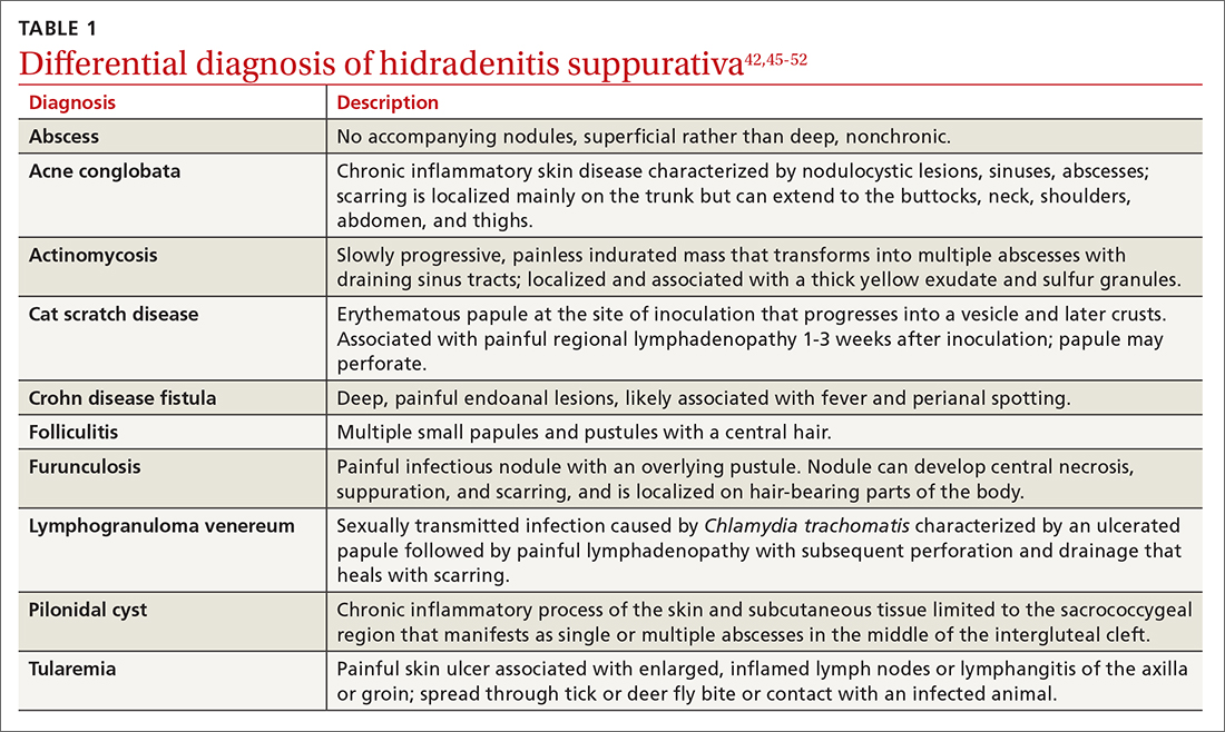 Differential diagnosis of hidradenitis suppurativa