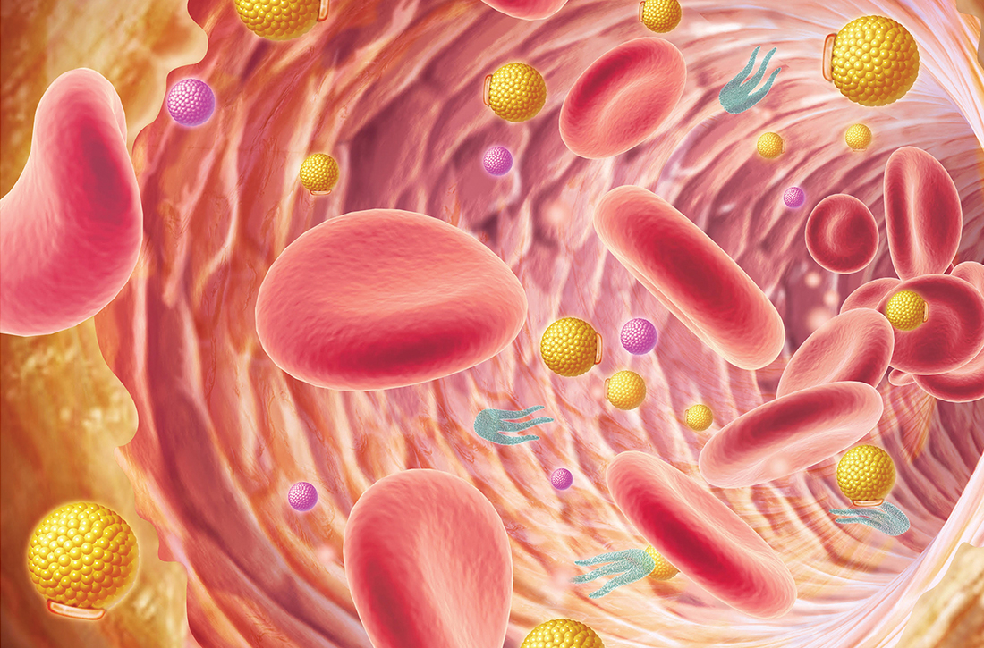 Hyperlipidemia