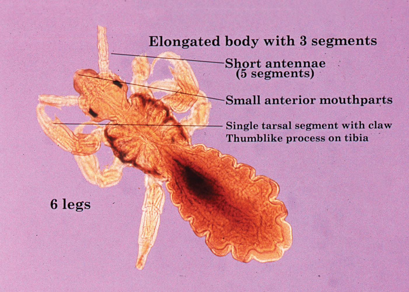 O Que Te Est A Comer Piolhos Do Corpo Humano Pediculus Humanus 