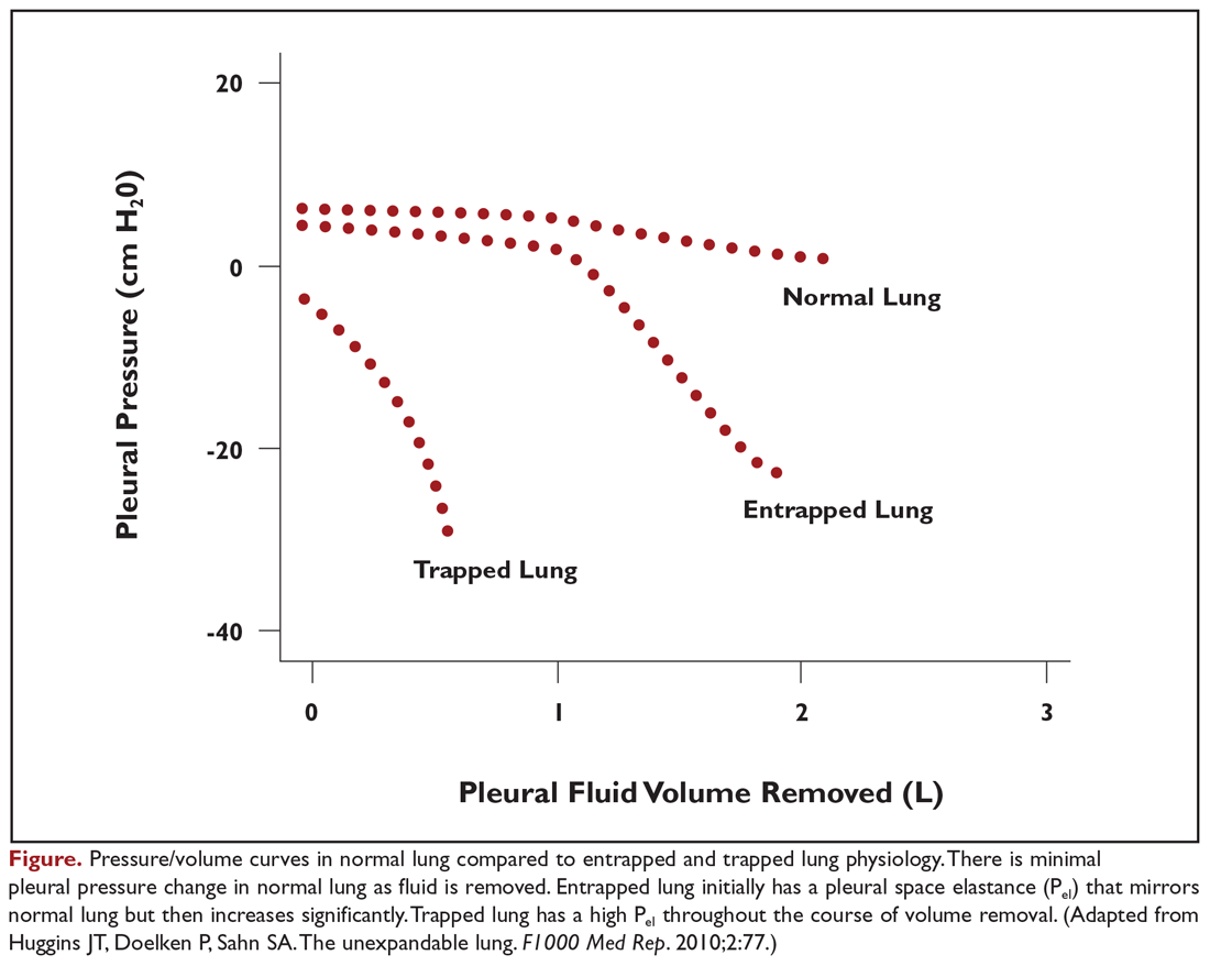 Pressure/volume curves in normal lung compared to entrapped and trapped lung physiology. There is minimal pleural pressure change in normal lung as fluid is removed.