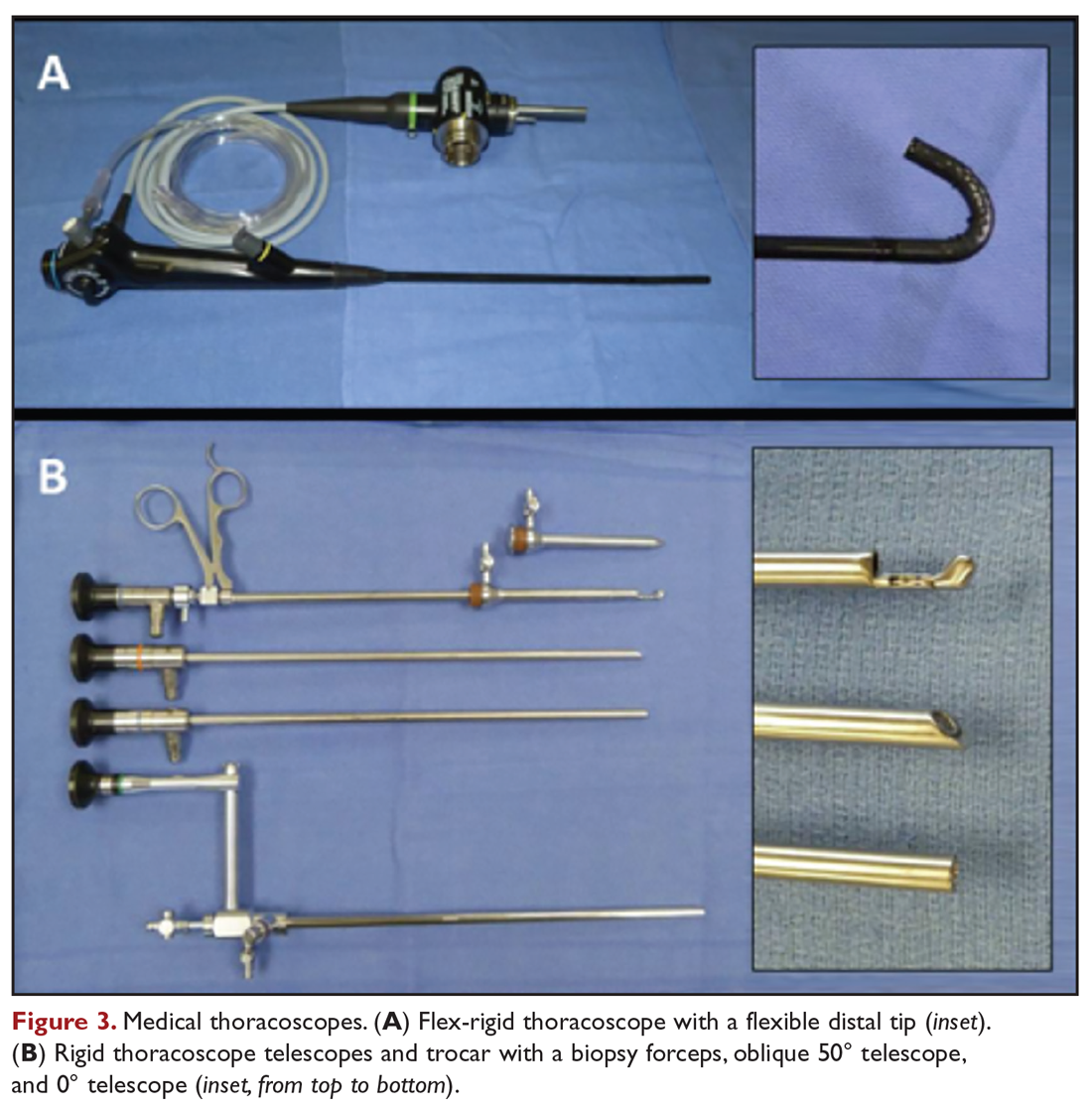 Medical thoracoscopes. (A) Flex-rigid thoracoscope with a flexible distal tip (inset). (B) Rigid thoracoscope telescopes and trocar with a biopsy forceps, oblique 50° telescope, and 0° telescope (inset, from top to bottom).