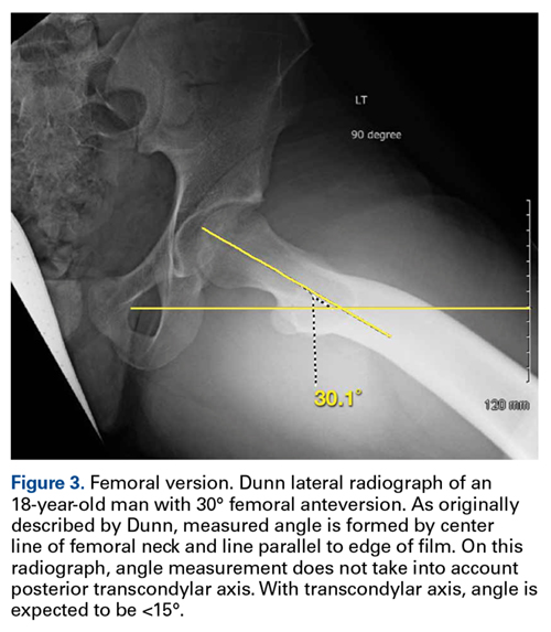 Imaging for Nonarthritic Hip Pathology | MDedge Surgery