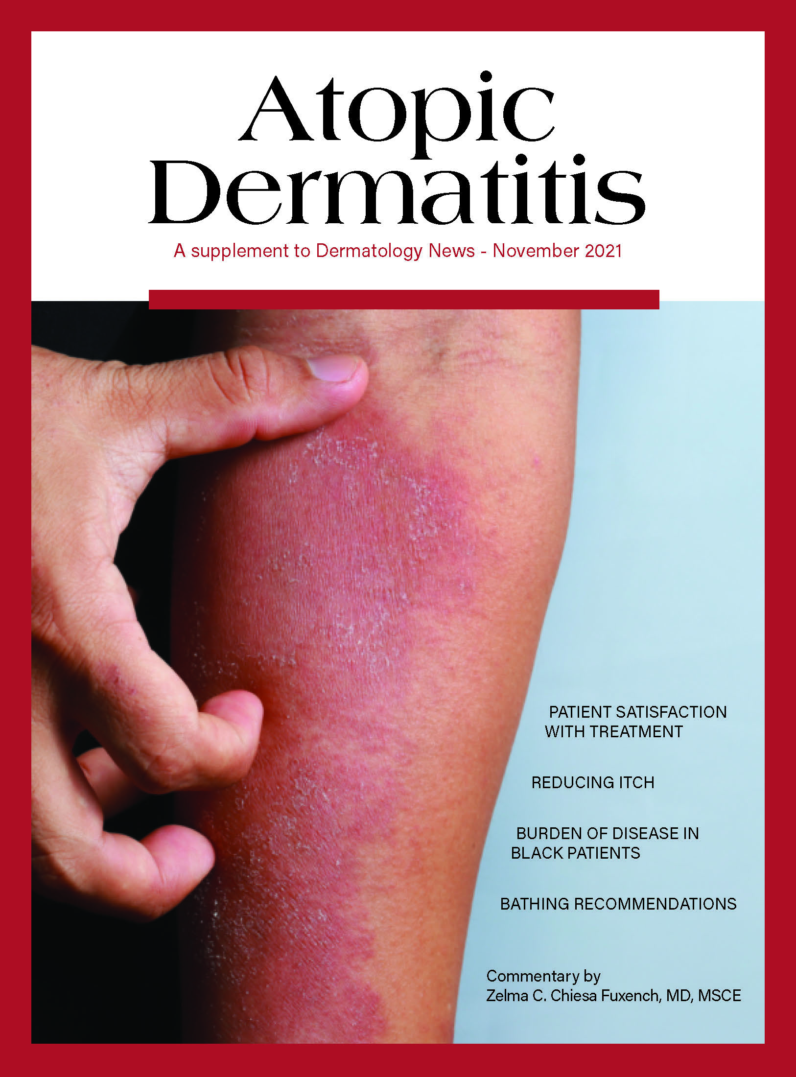 Dermatology Times on X: The November issue of Dermatology Times is live!  Learn more about age considerations for #AtopicDermatitis care, new data  related to #acne in adult women, and more. Download now