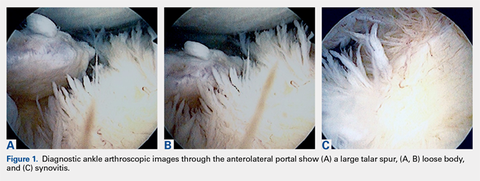 Diagnostic ankle arthroscopic images