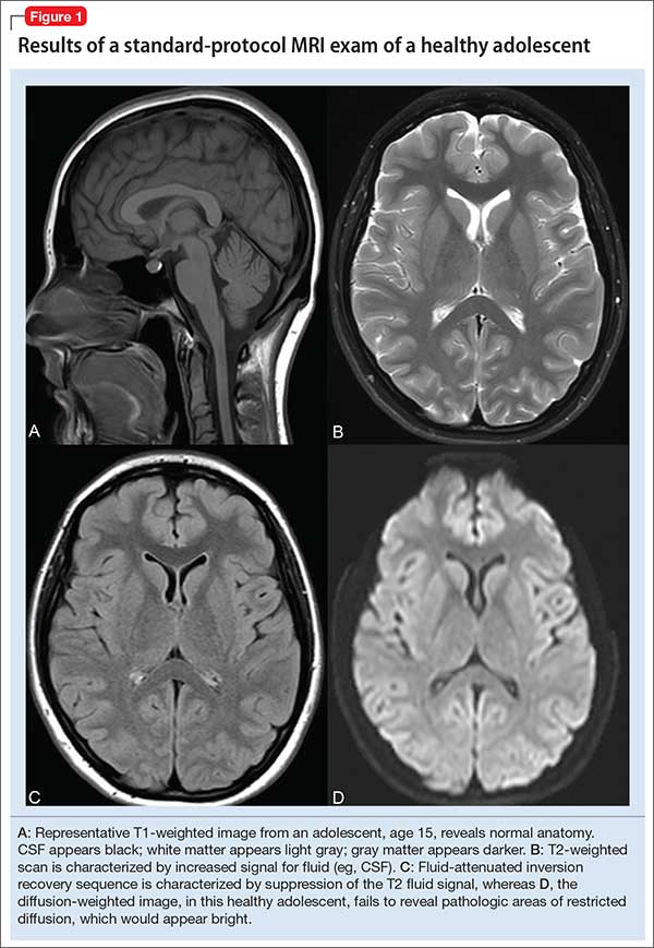 Results of a standard-protocol MRI exam of a healthy adolescent