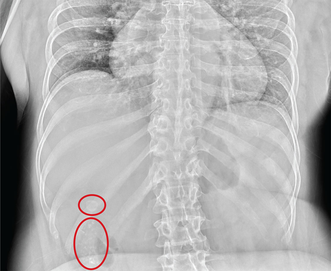 Fast Track to Abdominal Pain image