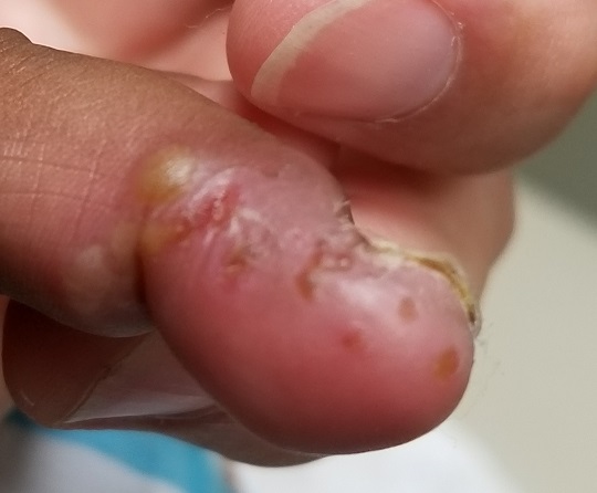 Can You Put Your Finger on the Diagnosis?