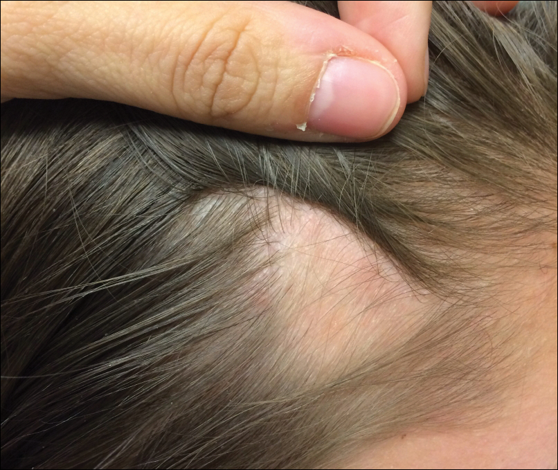 Red Spots On Scalp And Hair Loss 