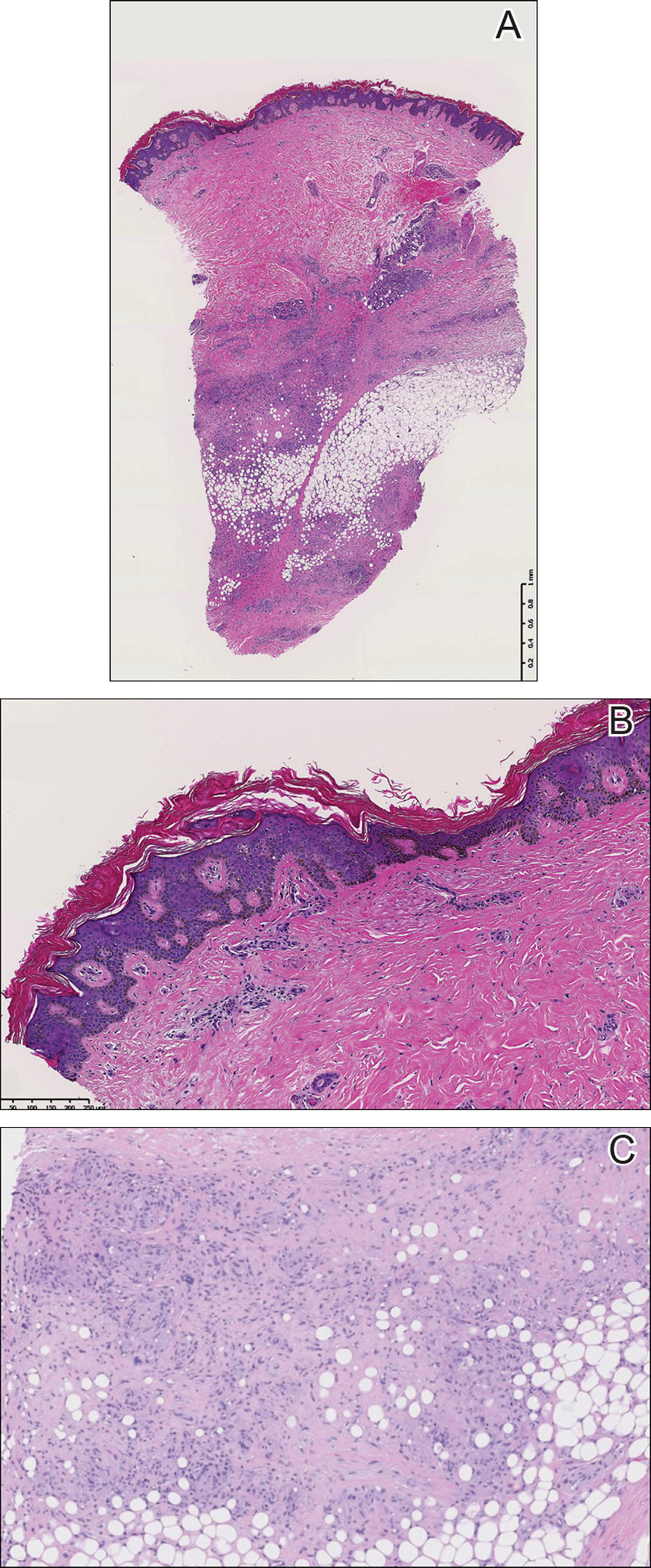 Figure2