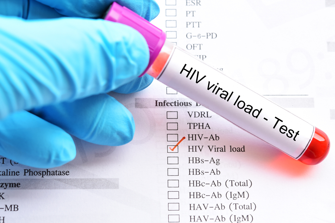 Blood sample HIV viral load test