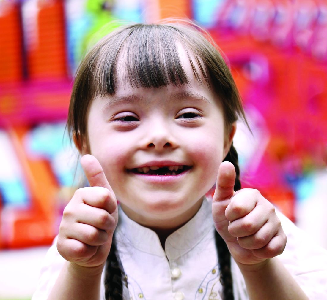 Down Syndrome Adalah Penyakit - Homecare24