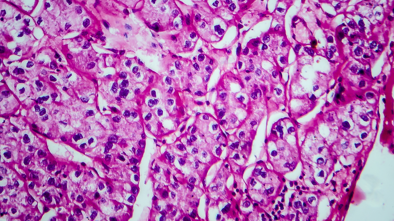 RCC microscope