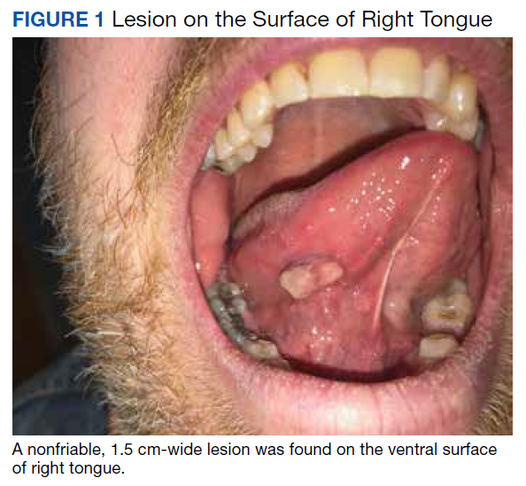tongue lashing