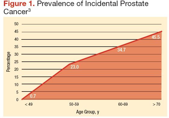 cancer prostate age