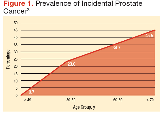 Prostate Cancer In Seniors Part 1 Epidemiology Pathology And Screening Avaho 2830