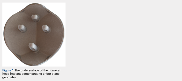 The undersurface of the humeral head implant demonstrating a four-plane geometry.