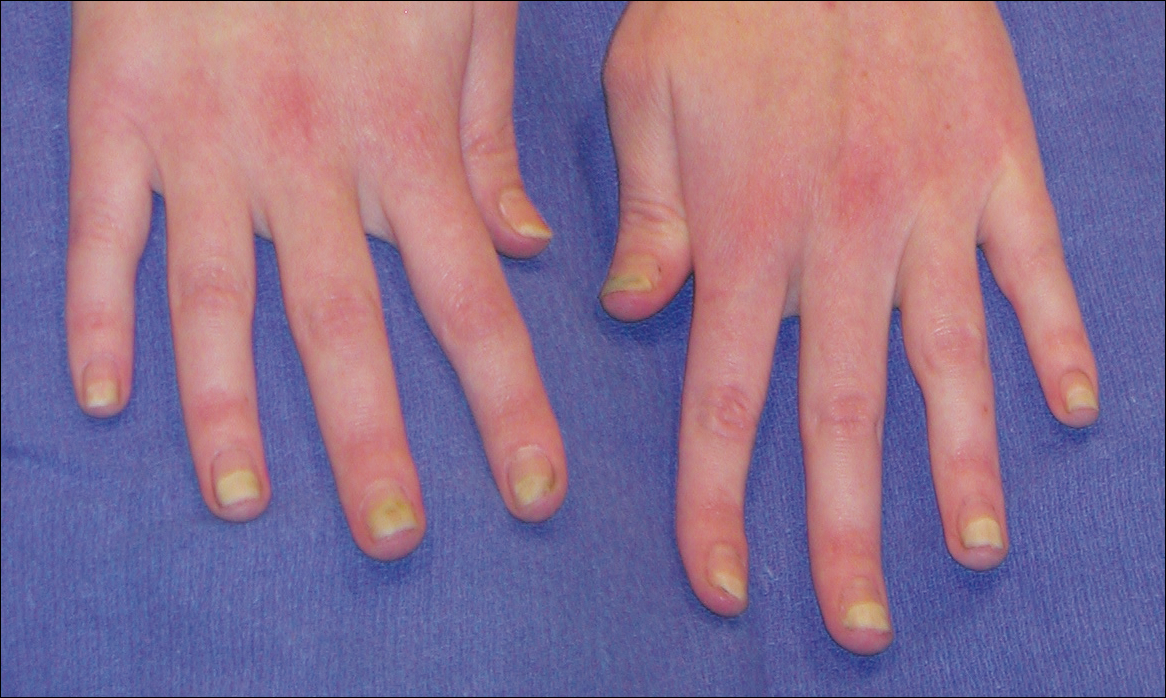 The Diagnosis and Treatment of Nail Disorders (25.07.2016)