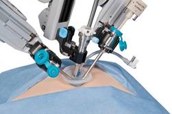 intuitive surgical da vinci cost