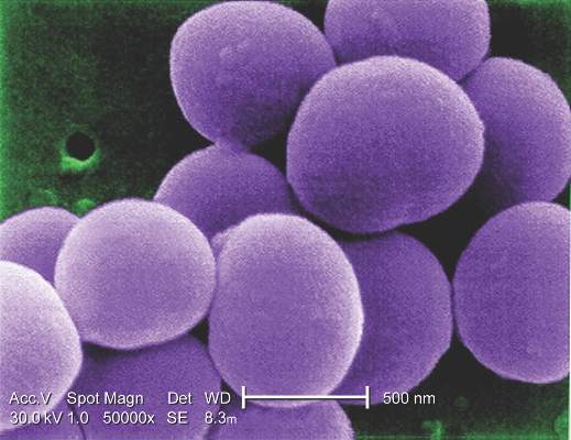 Staphylococcus aureus Bacteria, Scanning electron micrograp…