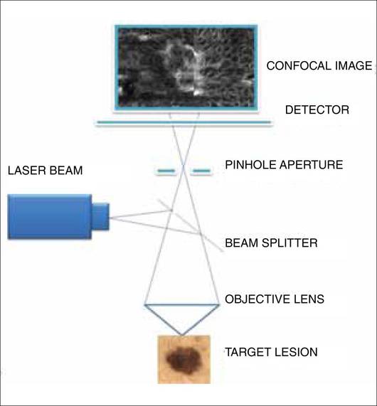 Diplomat Assume Make a bed Reflectance Confocal Microscopy: An Overview of Technology and Advances in  Telepathology | MDedge Dermatology