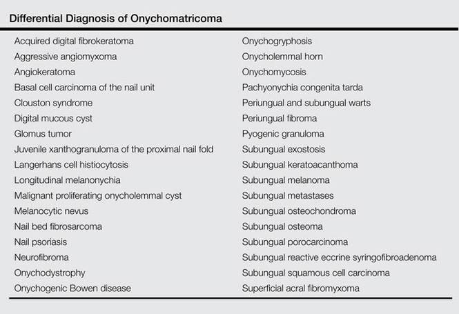 Onychomatricoma: An Often Misdiagnosed Tumor of the Nails | MDedge ...