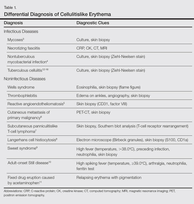 Tuberculous Cellulitis: Diseases Behind Cellulitislike Erythema ...