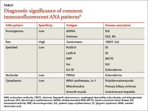 Antinuclear Antibodies When To Test And How To Interpret Findings MDedge