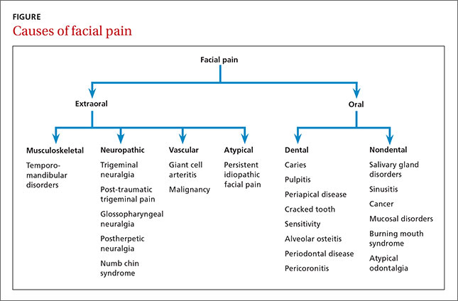 Facial Postherpetic Neuralgia Telegraph