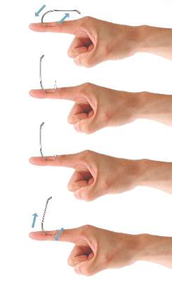 Don't Get Hung Up on Fishhooks: A Guide to Fishhook Removal