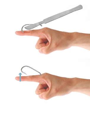 PDF) A simple method for removal of fish hooks in the emergency department  [2]