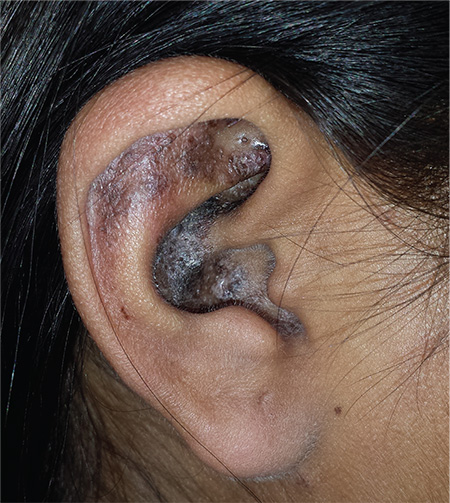 Trend kom doneren The Ears Have It (and She Doesn't Want It) | Clinician Reviews