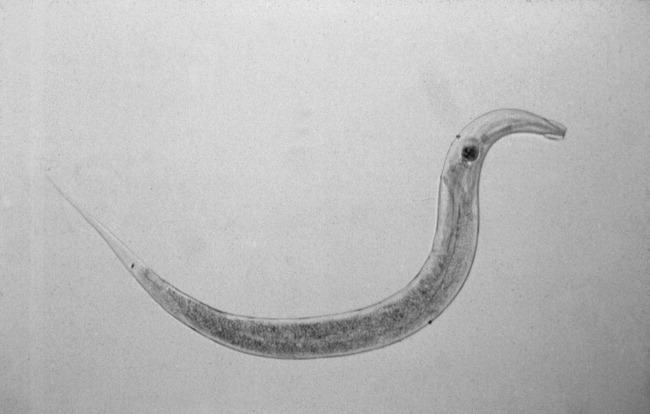 Pinworm: tünetek és kezelés Széklet egy tojásféregben egy gyermek számára
