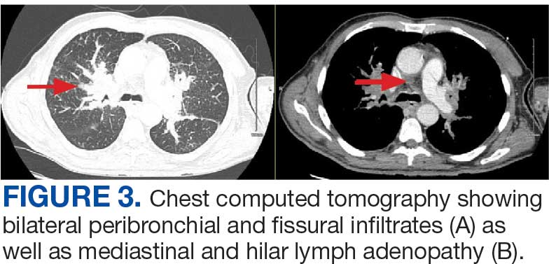 0825FED-AVAHO-Prostate-F3