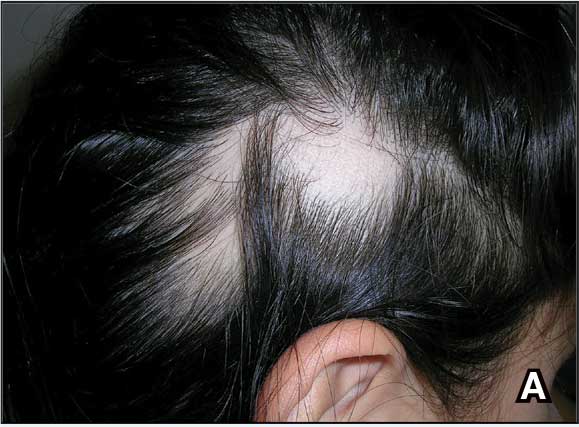 0825Fed-Cutis-Fa