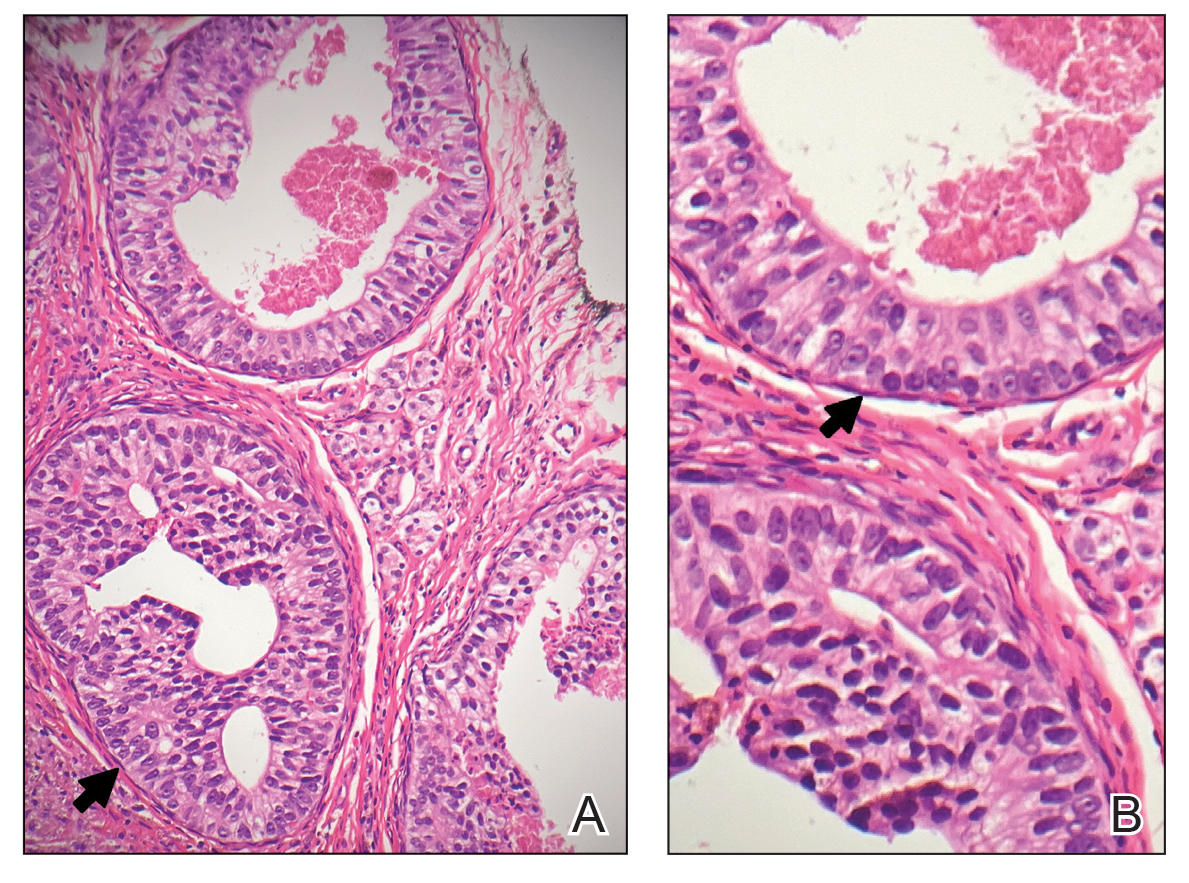 CT115001007_e-Fig3_AB