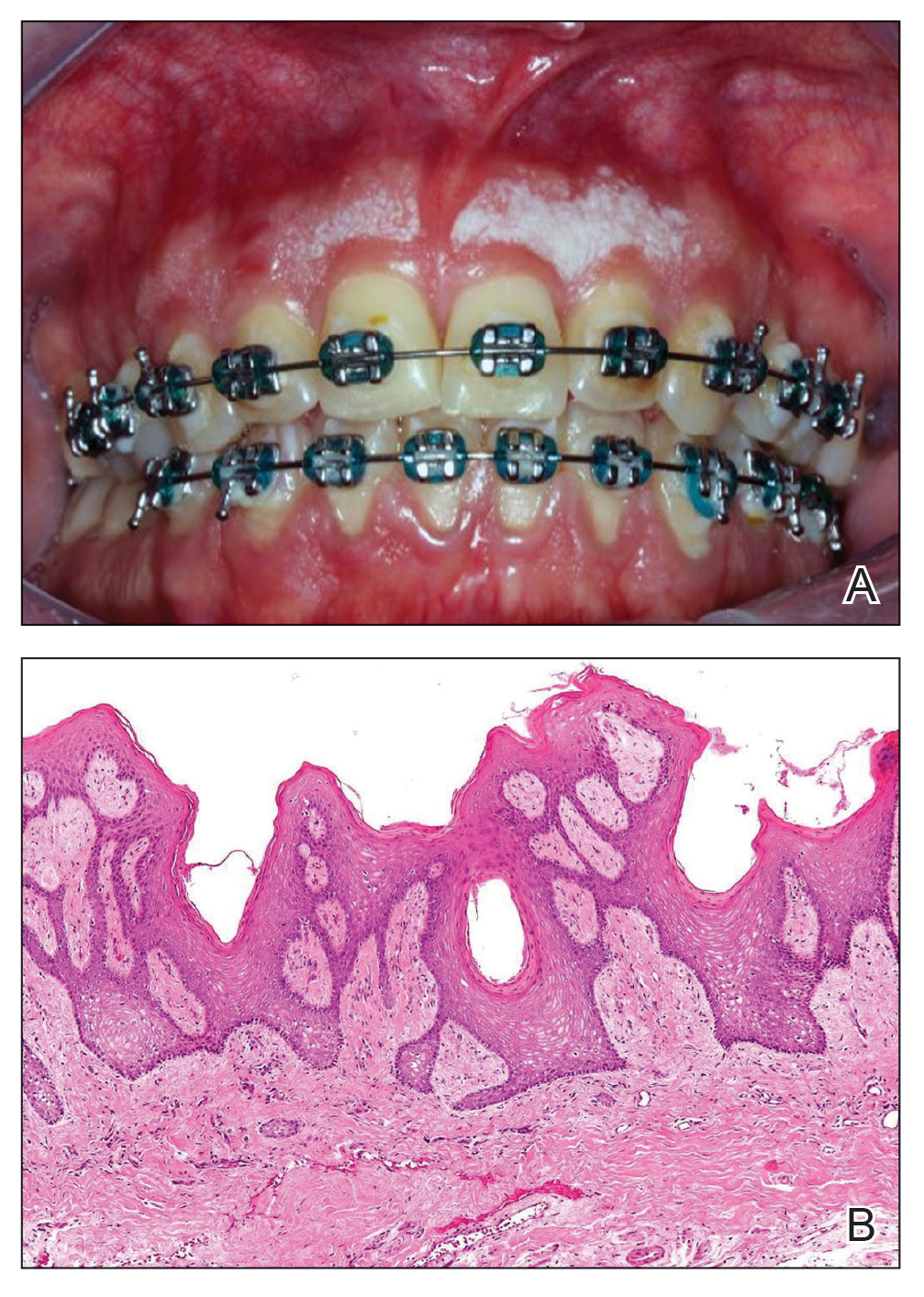 CT115002008_e-Fig1_AB