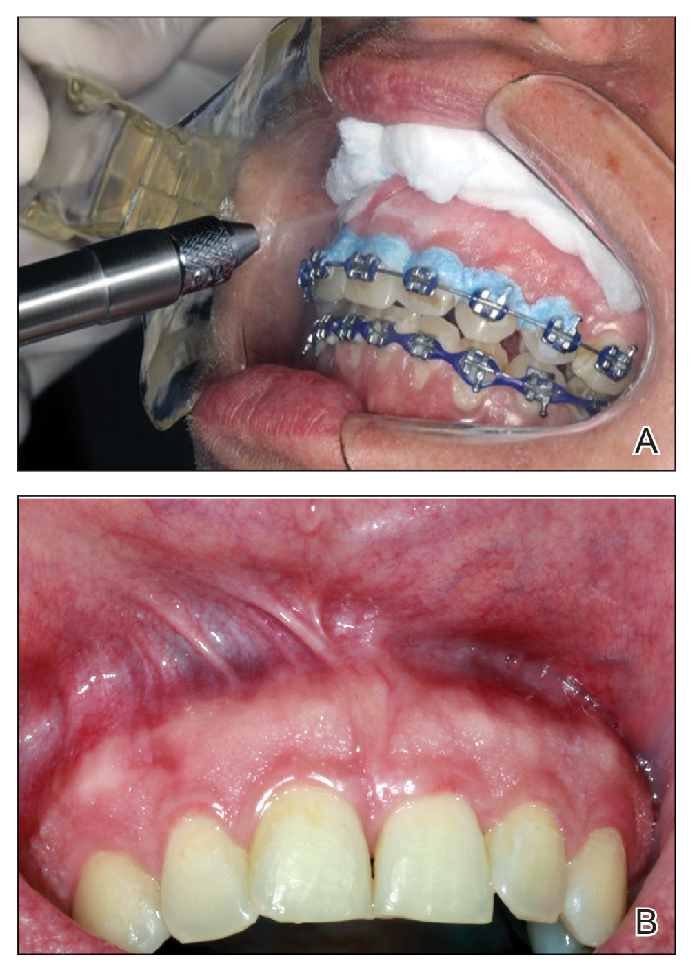 CT115002008_e-Fig2_AB