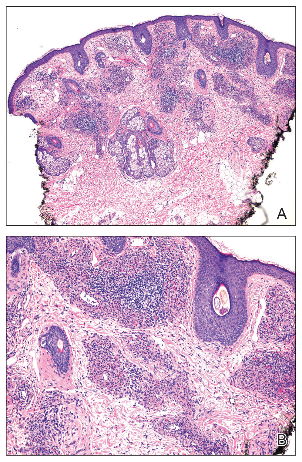 CT115002014_e-Fig1_AB
