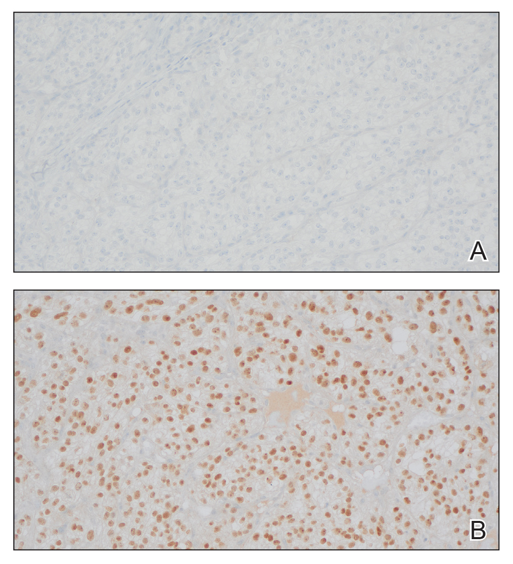 CT115003021_e-Fig2-AB