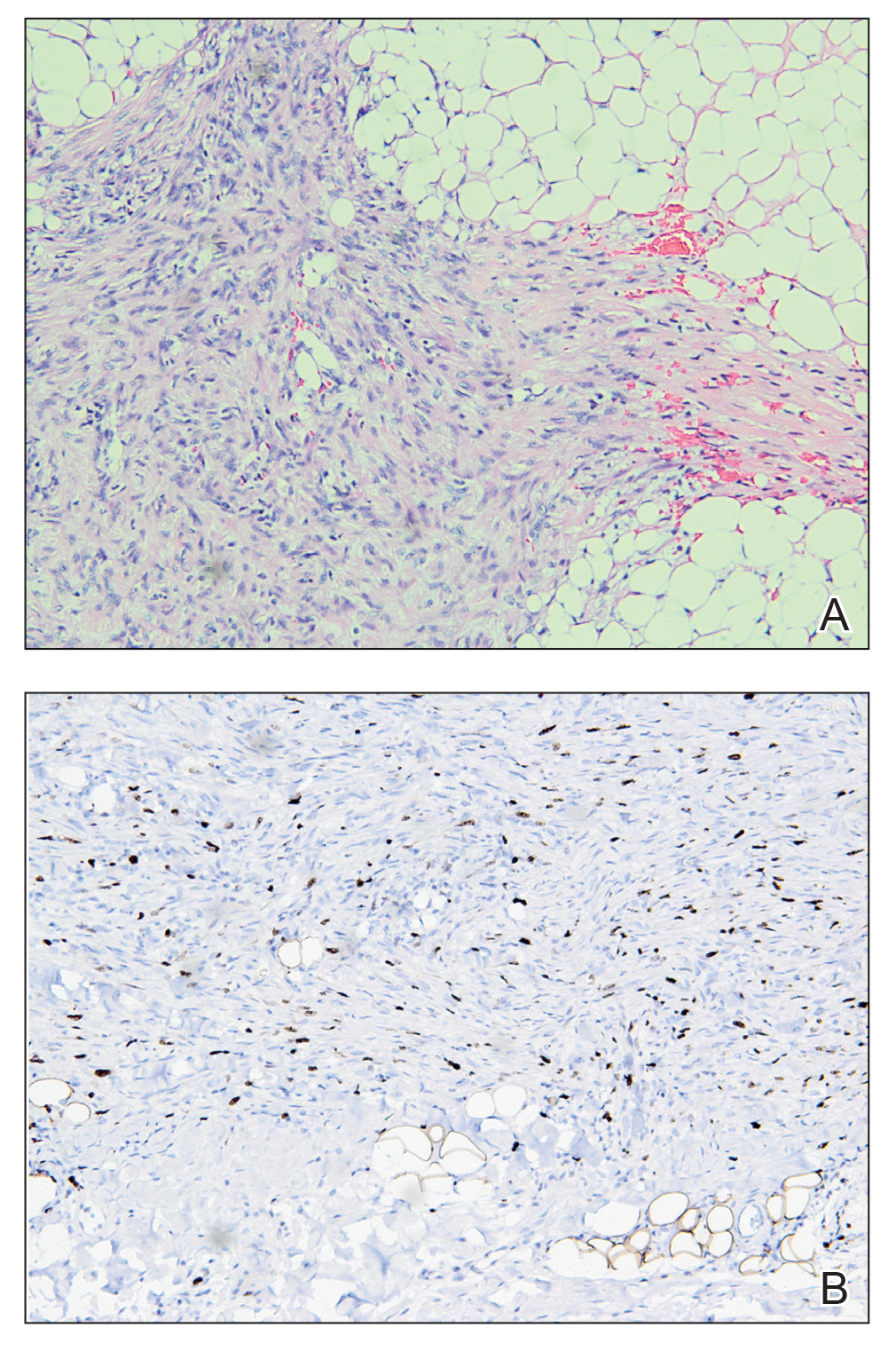 CT115004110-Fig2-AB