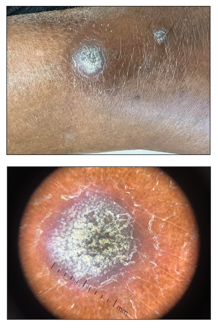 CT115005150-Quiz-top_bottom