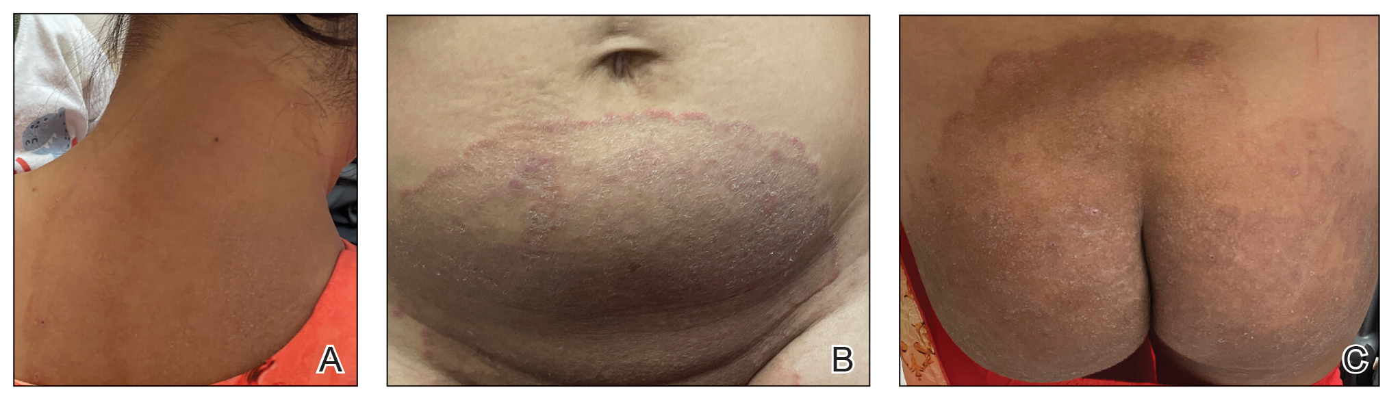 CT115005151-Fig1_ABC