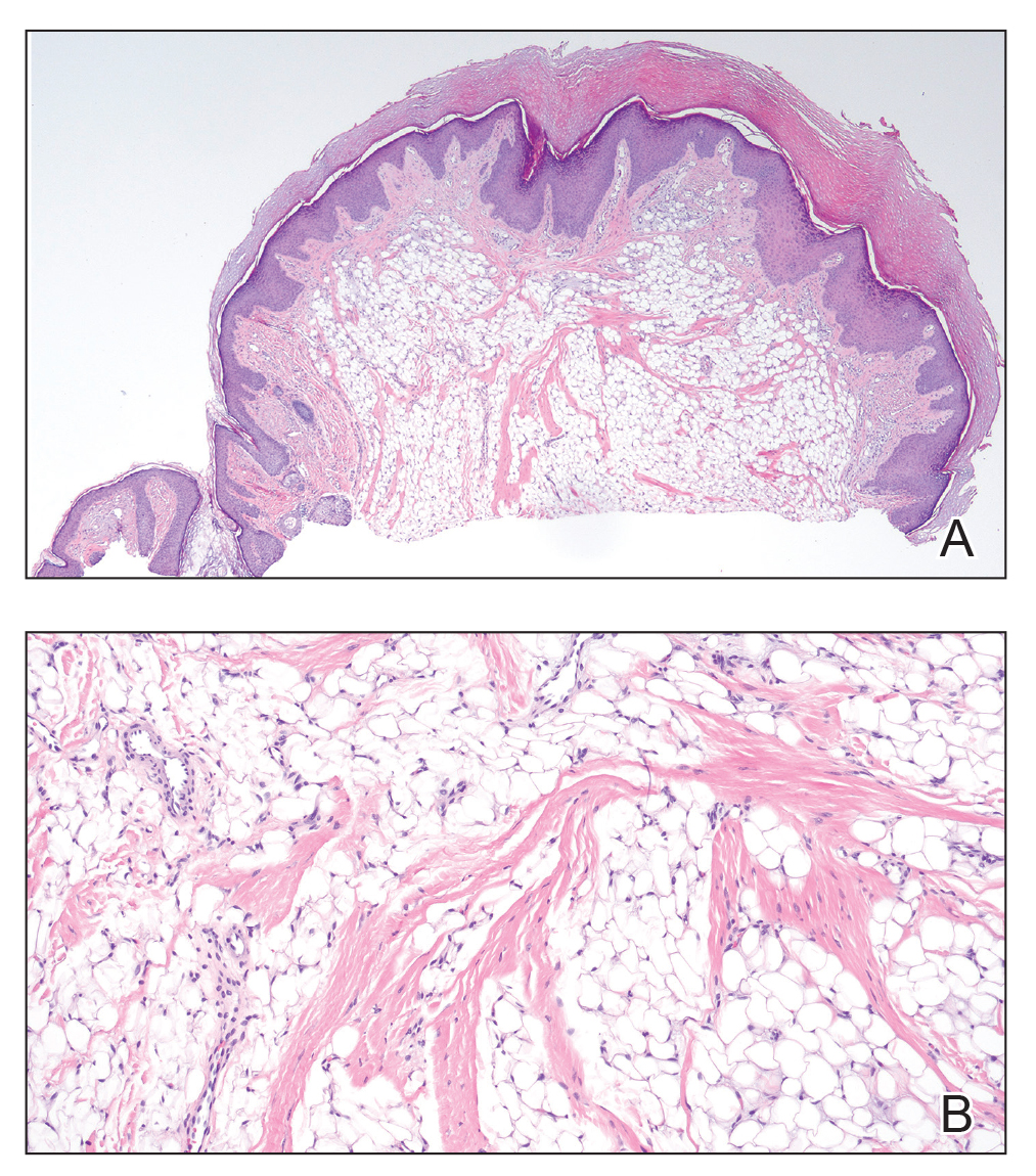 CT116001008_e-Fig1_AB
