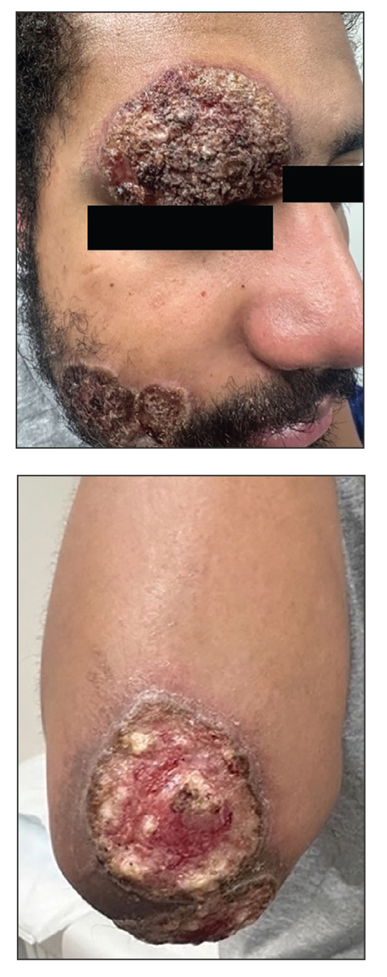 CT116001010-Quiz_top_bottom