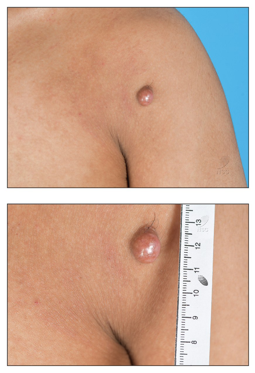 CT116002069-Quiz_top_Bottom