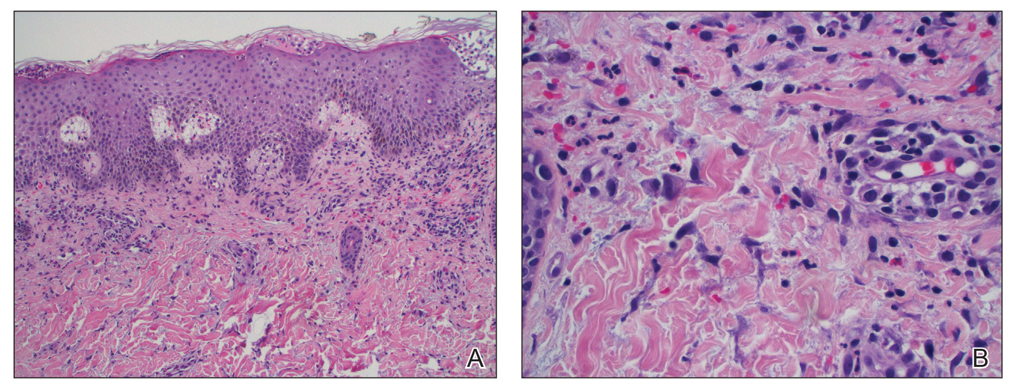 CT116003018_e-Fig2_AB