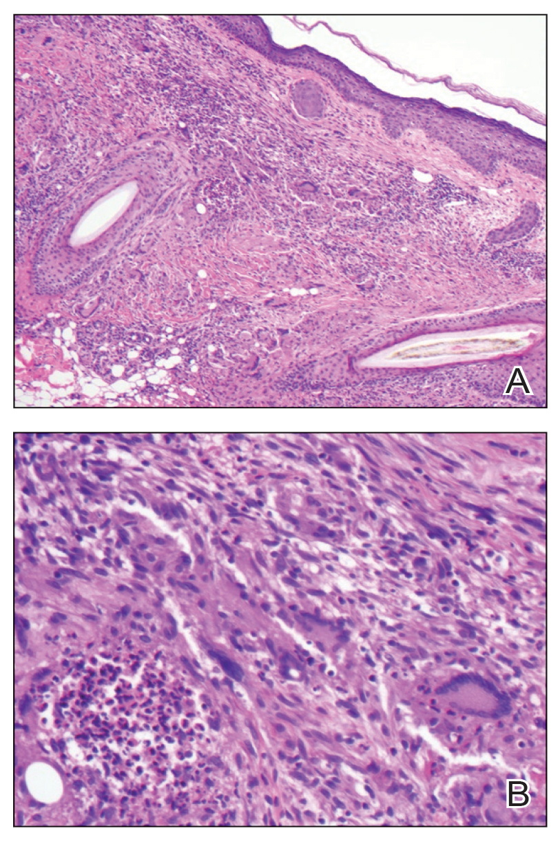 CT116003022_e-Fig2_AB