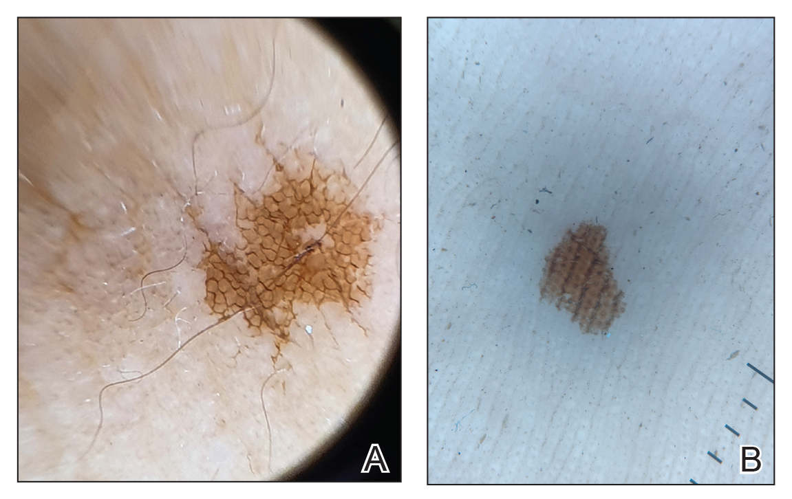 CT116003094-Fig2_AB